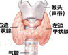 甲状腺癌症状