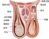 精索静脉曲张常识