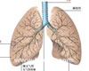 慢性支气管炎常识
