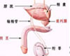 前列腺癌症状