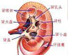 肾功能衰竭常识