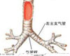 支气管哮喘症状