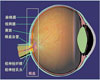 眼底病变常识