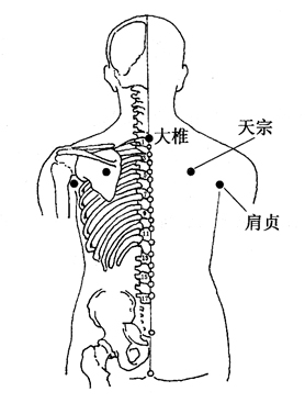 图3-3-1大椎、天宗、肩贞