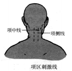 项区刺激线