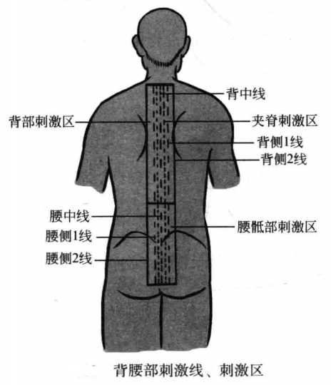 背腰部刺激线、刺激区